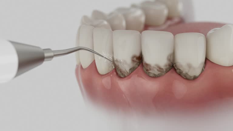 Reliable Emergency Dentist contractor in Lighthouse Point, FL by Smile Center Dentistry